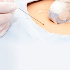 Coprisonda non sterile latex free 15x61 cm