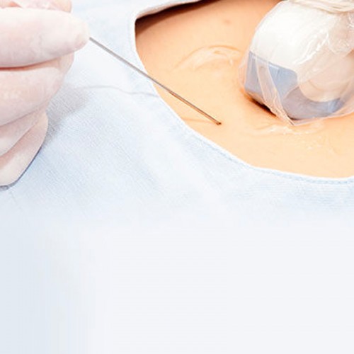 Coprisonda non sterile latex free 15x61 cm